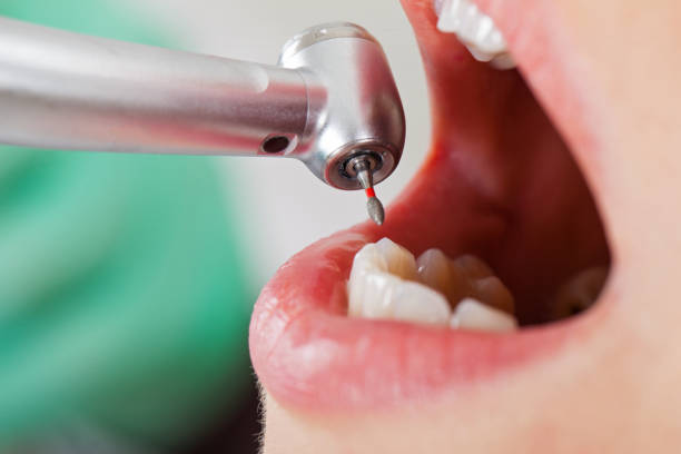 Best Dentist for Tooth Abscess  in Tigerville, SC